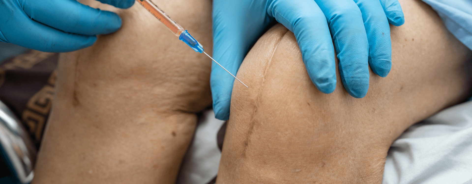 PRP joint injection therapy performed by a medical professional