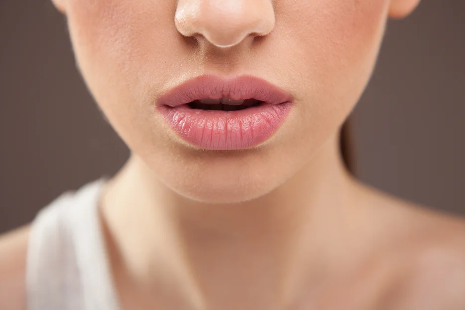 a woman with fuller lips after cherry lip fillers 