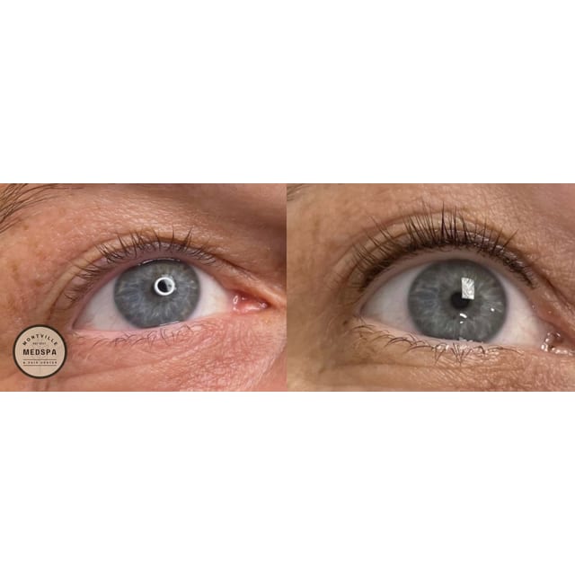 Before and after: eyeline enhancement