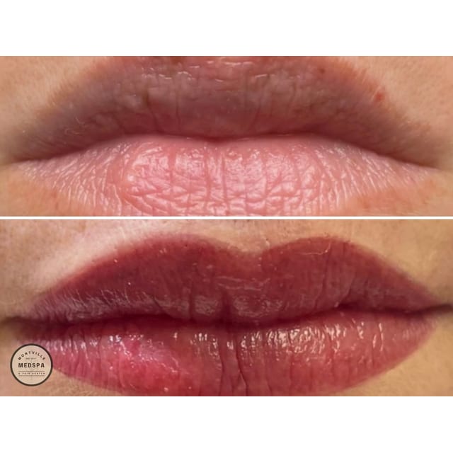 Before and after: lip blushing