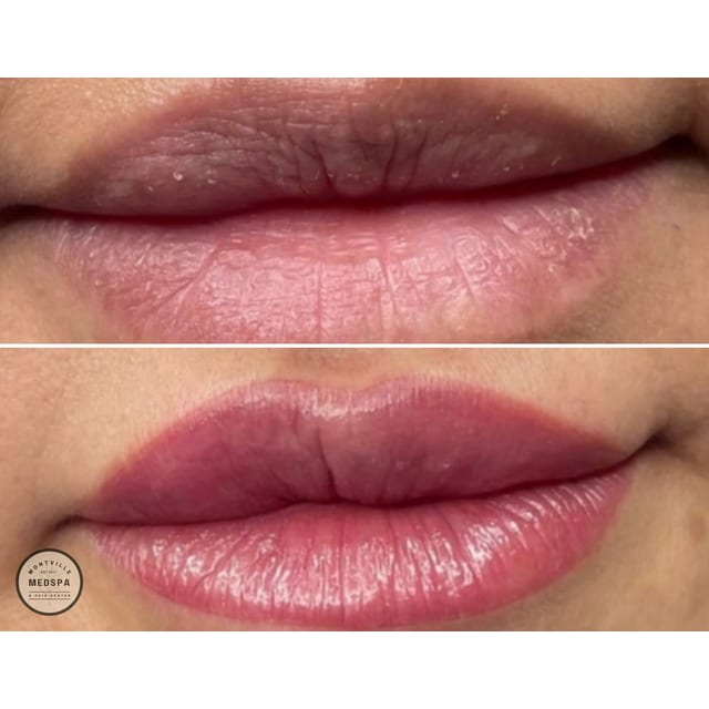 Before and after: lip blushing