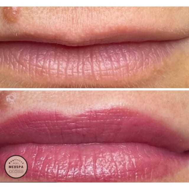 Before and after: lip blushing