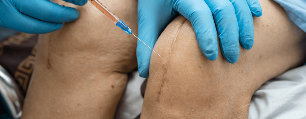 PRP joint injection therapy performed by a medical professional