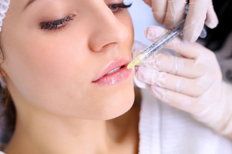 a woman received lip filler injections