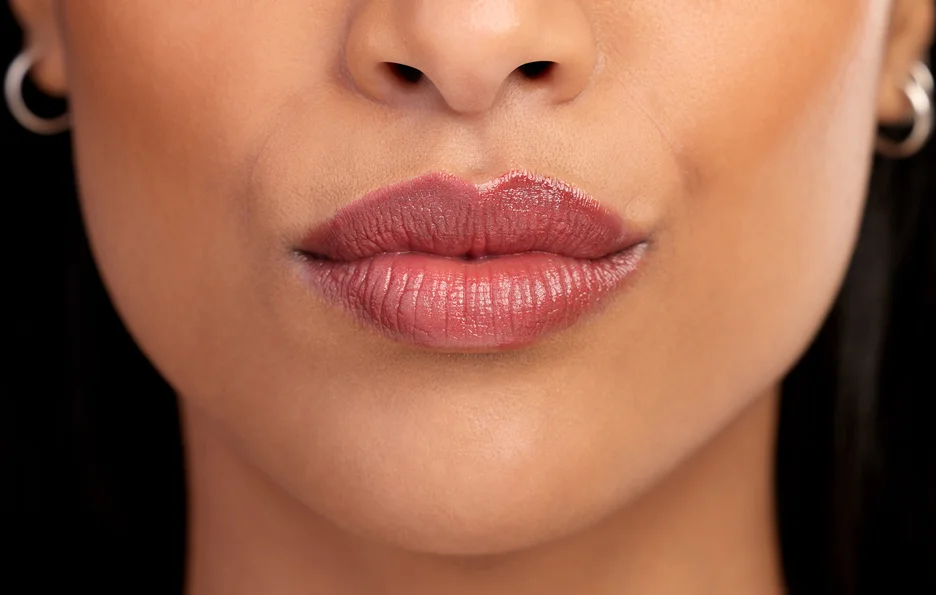 which lip filler lasts the longest